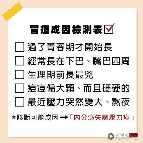 下巴痘痘反复长？下巴长痘痘原因、改善方法详解，8款“克下巴痘”神品推荐！ 最新 图2张