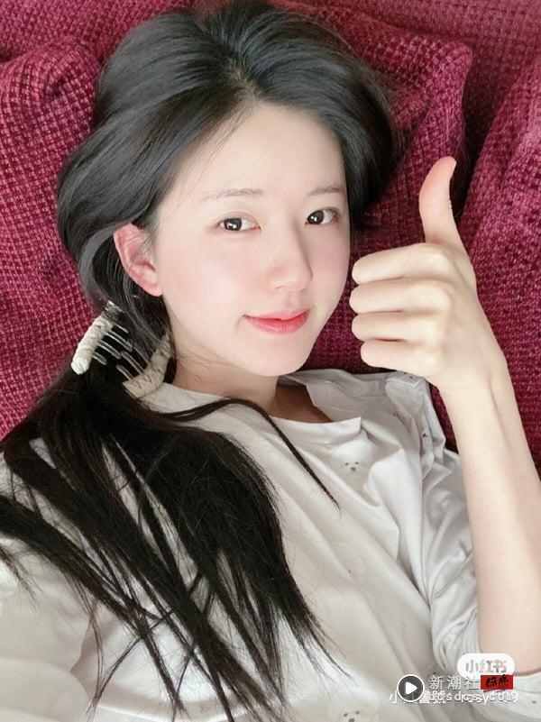椰子水有什么功效？10大好处＋禁忌：润肺止咳、改善水肿、预防痘痘 最新 图5张