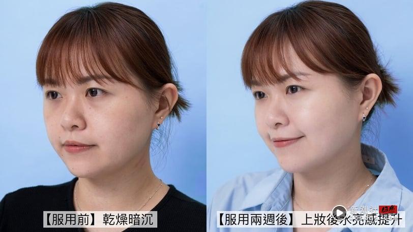 韩妞水光作弊神器！“吃的爆水胶囊”一颗95%玻尿酸冲破保湿天花板，脸蛋嫩到掐出水 最新 图2张