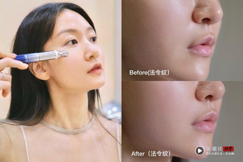 “震”走年龄焦虑！编辑挖宝A醇抗皱神品，网友好评激推：纹路克星，还原少女感就靠它 最新 图2张