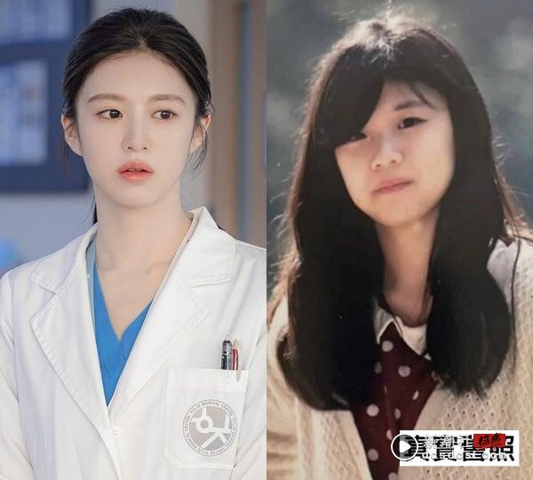 《机智住院医生》高允贞陷整形争议？韩剧10女星旧照，韩志旼宋慧乔没变，IU现在美多了 娱乐 图2张