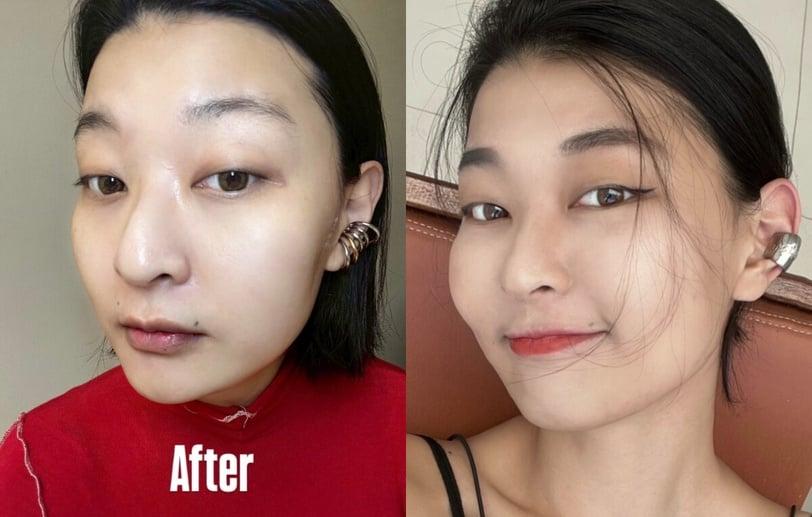 快来抄笔记！解救夏天崩溃满脸油光时刻，加码热门医美推荐！实测有感控油攻略看这篇！ 最新 图8张