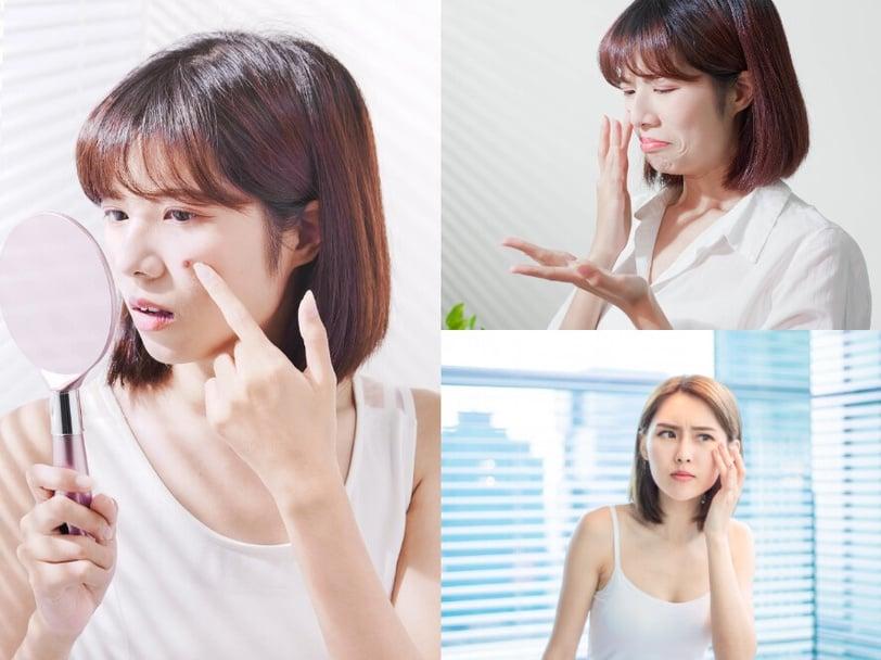 快来抄笔记！解救夏天崩溃满脸油光时刻，加码热门医美推荐！实测有感控油攻略看这篇！ 最新 图1张